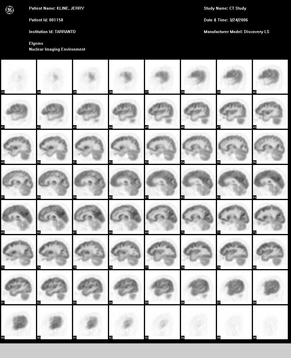 Sagittal PET Images